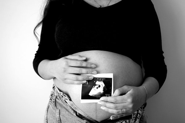 Comment choisir les meilleurs suppléments nutritionnels pour la santé des cheveux et des ongles?